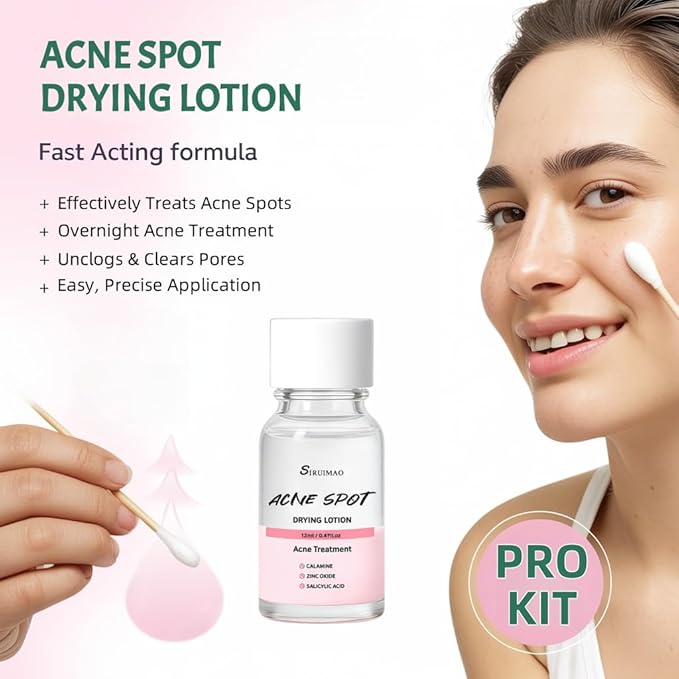 Premium Acne Spot Drying Lotion Kit with Swab, Overnight Acne Treatment For Face, Dry Out Pimples, Blemishes, Zits And Clean Pores, 12ml / 0.41 FlOz