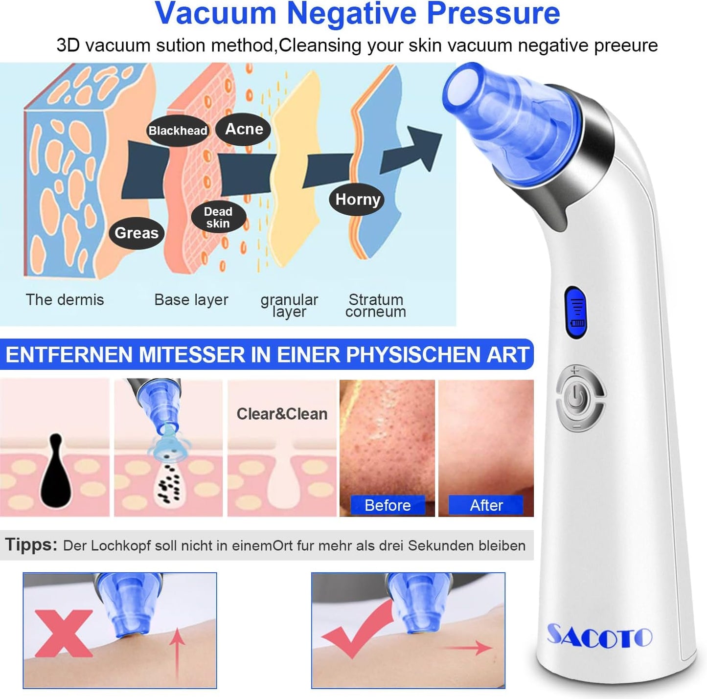 Blackhead Remover Pore Vacuum, Face Suction Pore Cleaner, 5 Suction Power Electric Blackhead Extractor Tool, 4 Probes, Blackhead Suction Remover for Women & Men（Blue）